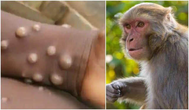 میزان اثرگذاری واکسن آبله بر «آبله میمونی»