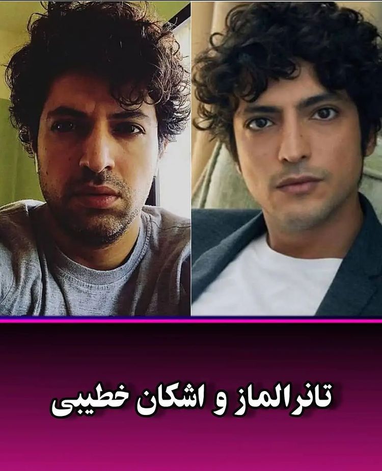 این بازیگران ایرانی، بدل ترکیه‌ای دارند ! 