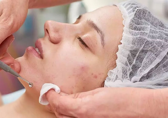 قیمت فیشیال صورت چقدر است؟