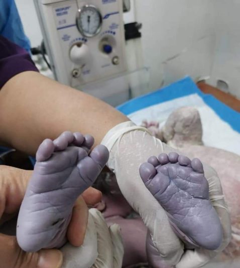 تولد نوزادی عجیب‌الخلقه در بغداد! 