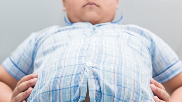 دستورالعمل جدید برای درمان کودکانِ چاق