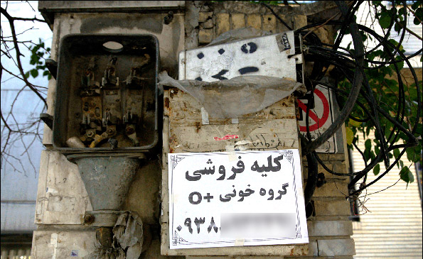 اینجا، تهران؛ فروش مغز استخوان، یک میلیارد تومان