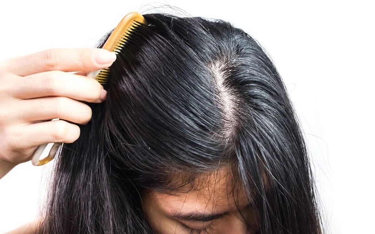 ۵ روش برای رهایی از چربی مو