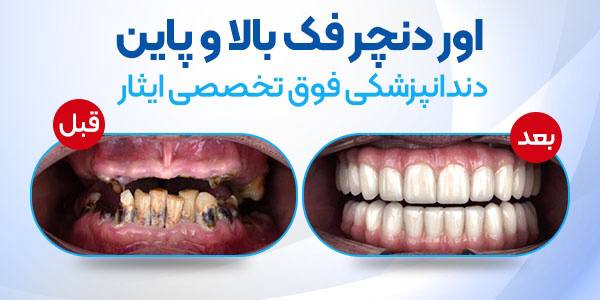 خدمات دندانپزشکی زیبایی چیست؟