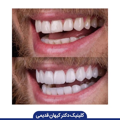متخصص کامپوزیت دندان چه ویژگی‌هایی دارد؟
