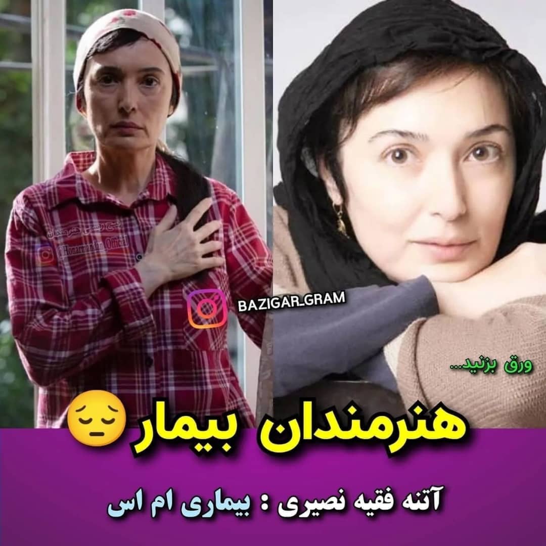 بازیگران و چهره‌هایی که بیماری خاص دارند