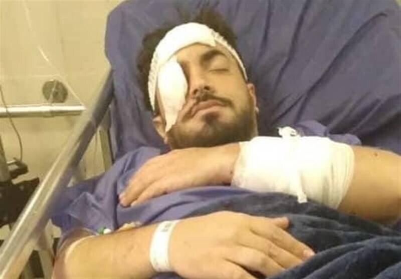 حمام خون در تهرانپارس با ضرب و شتم یک روحانی