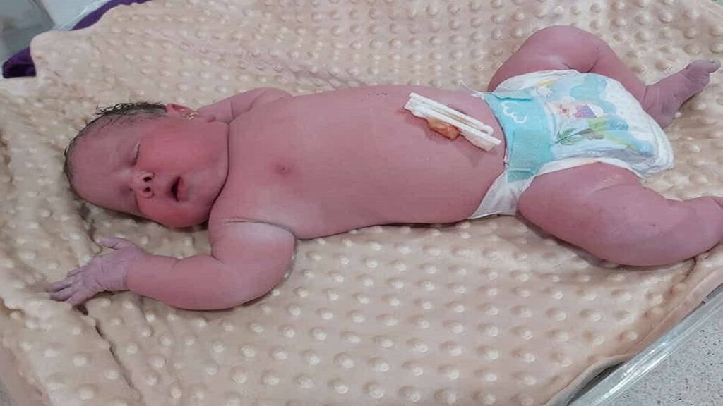 نوزاد 5.5 کیلویی در اردکان متولد شد