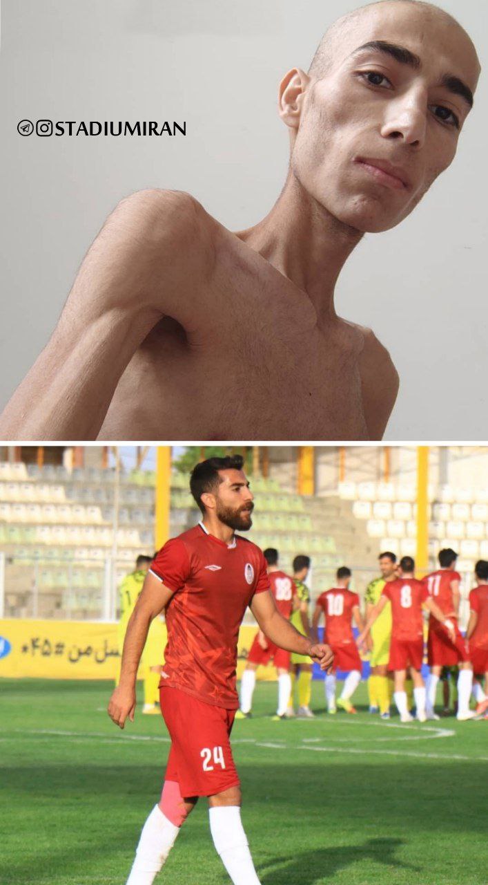 عکس باورنکردنی از فوتبالیست ایرانی بعد از سرطان