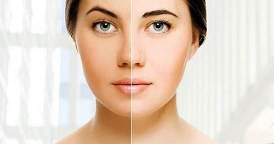 برای روشن شدن پوست بهتر است از کانسیلر استفاده کنیم یا ماسک صورت؟