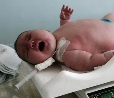 سنگین‌ترین نوزادان جهان در بدو تولد را بشناسید