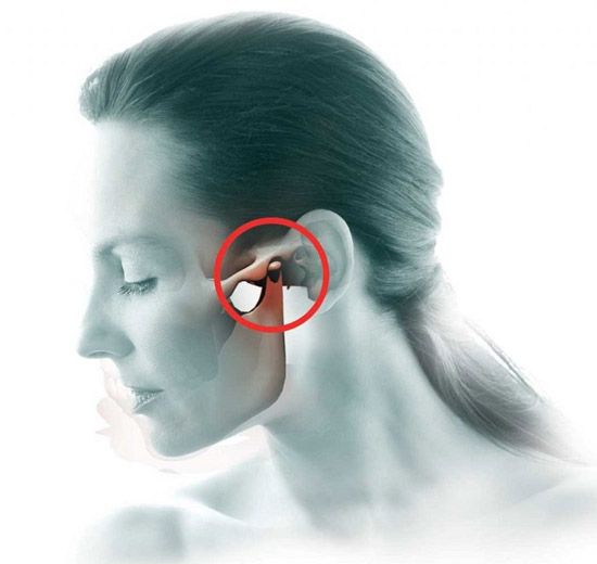 درمان درد اختلال مفصل گیجگاهی فکی TMJ (بیماری فک و صورت)