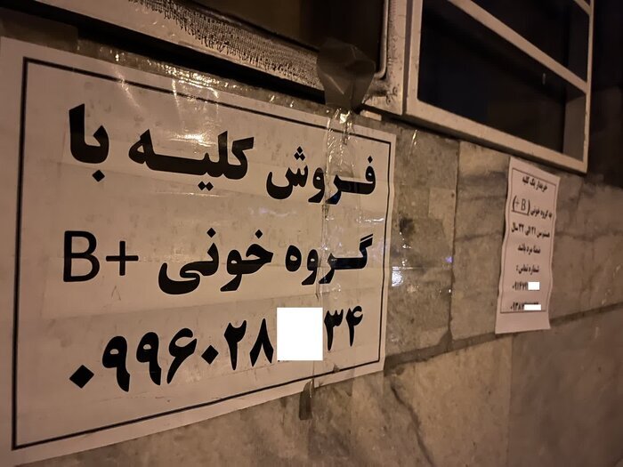 فروش دلاری کلیه با ایرانیان در سفر به ترکیه و عراق