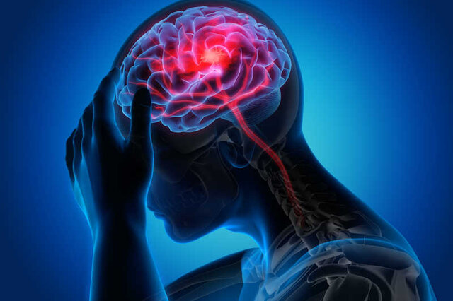 علائم اصلی سکته مغزی چیست؟