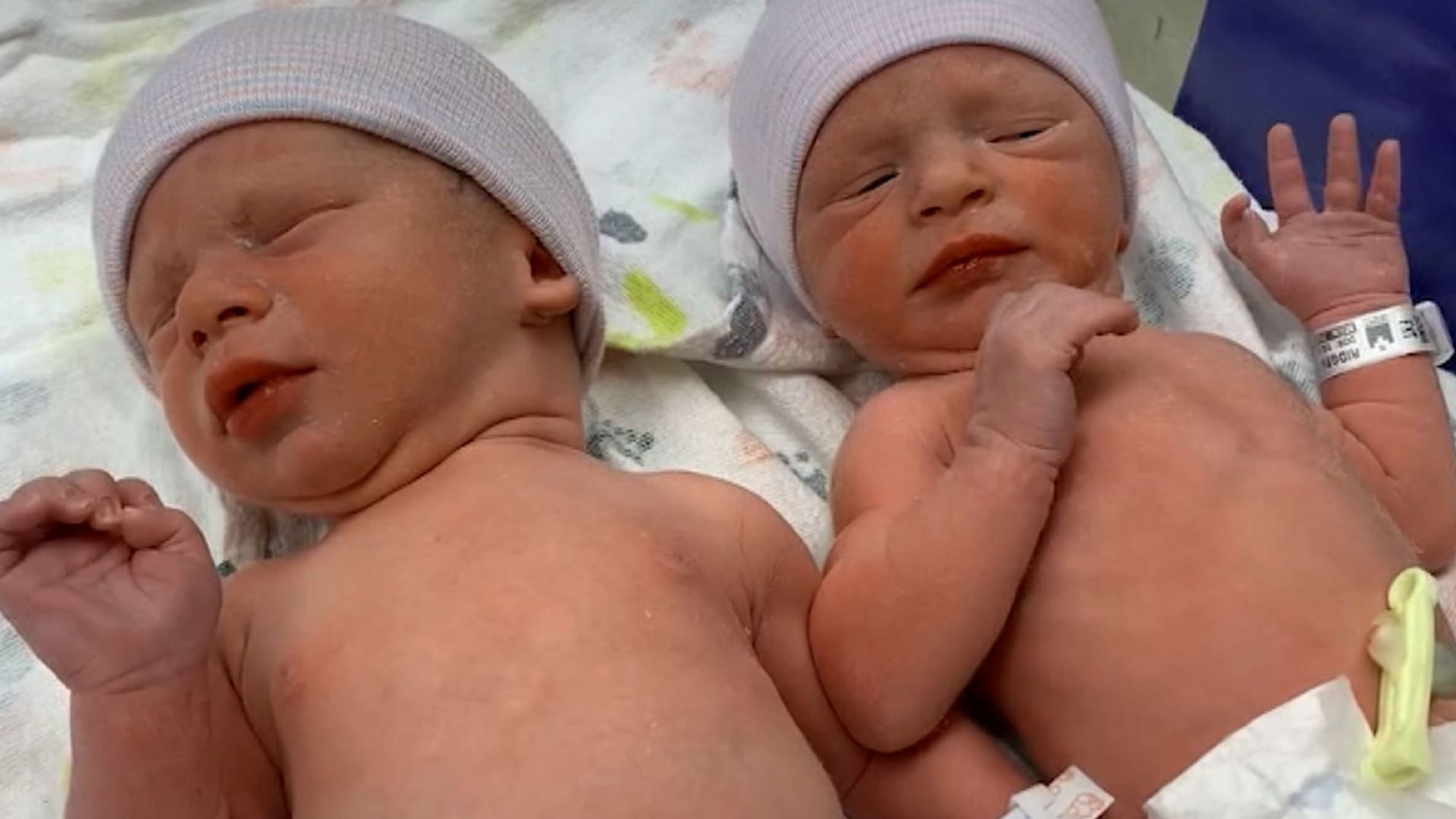 تولد دو نوزاد از نطفه‌هایی که 30سال منجمد بودند