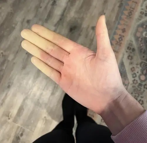 انگشت‌های دستِ این آقا هر کدام یک رنگ متفاوت دارد