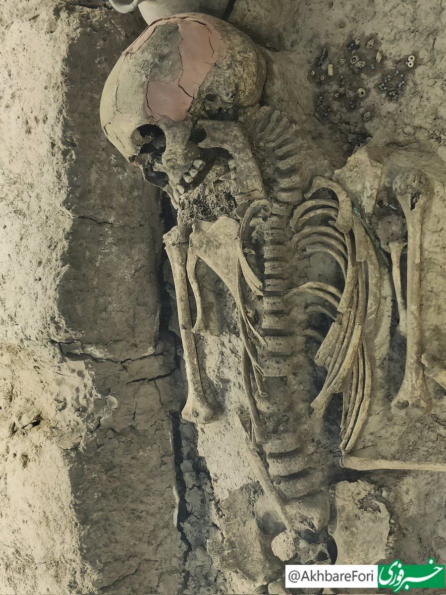 کسی از اسکلت ۳۱۰۰ ساله یک دختربچه ۱۲ ساله که در قزوین