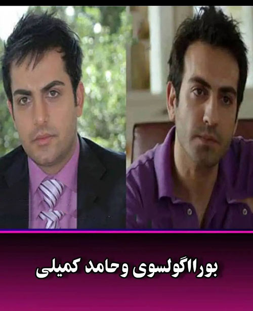 این بازیگران ایرانی، بدل ترکیه‌ای دارند ! 