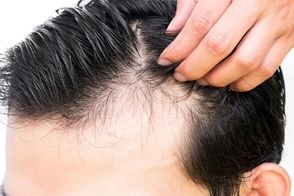 تاثیر استرس در بروز بیماری‌های پوست و مو