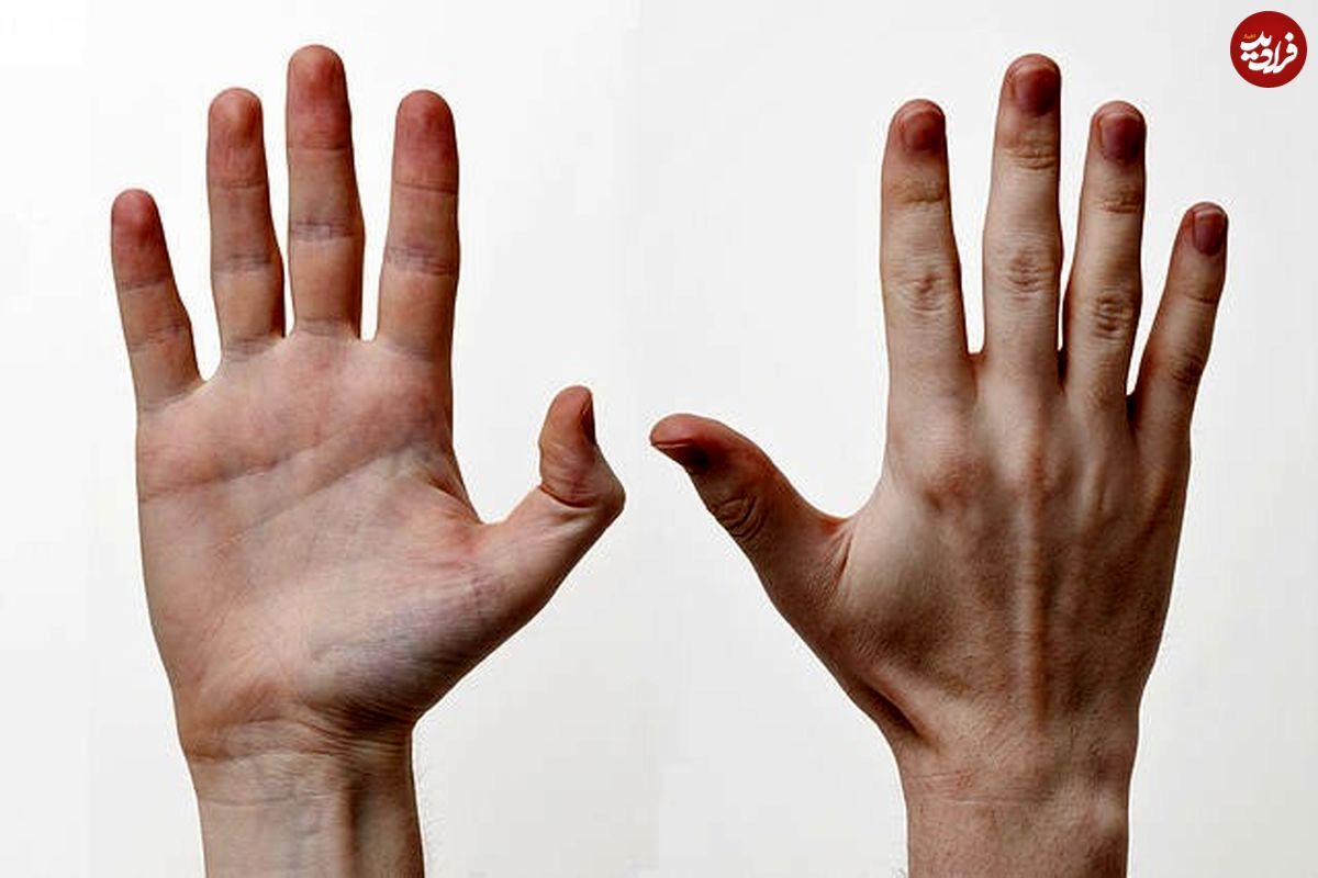 چرا در هر دست تنها پنج انگشت داریم؟!