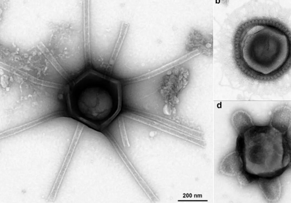 کشف ویروس‌هایی با شکل‌های عجیب در خاک جنگل