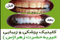 کامپوزیت ارزان